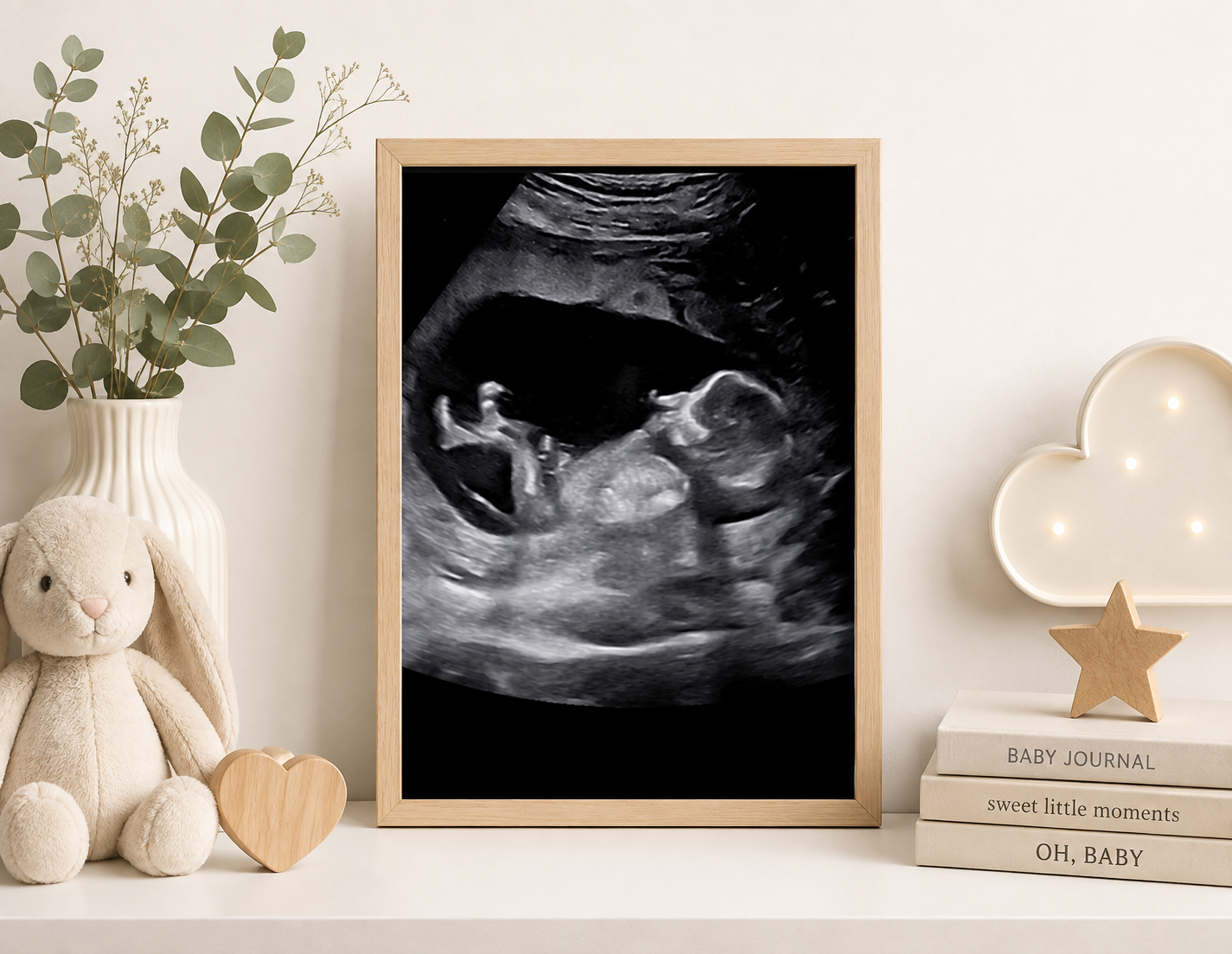 3D Ultrasound Baby Visuals