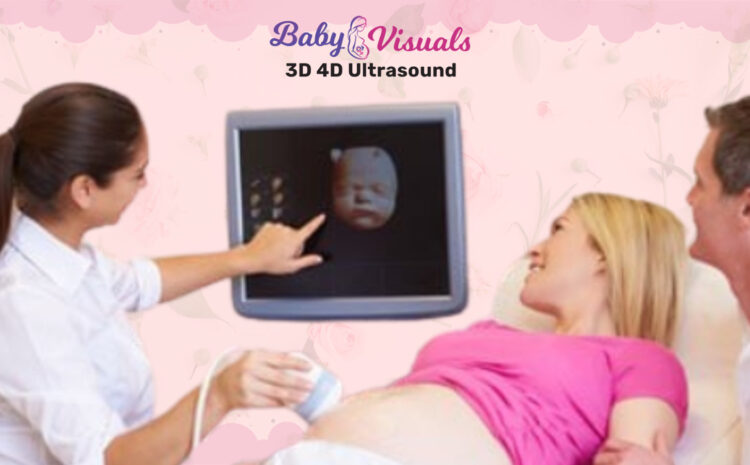  How to Prepare for Your 3D 4D Ultrasound Session: Tips and Tricks