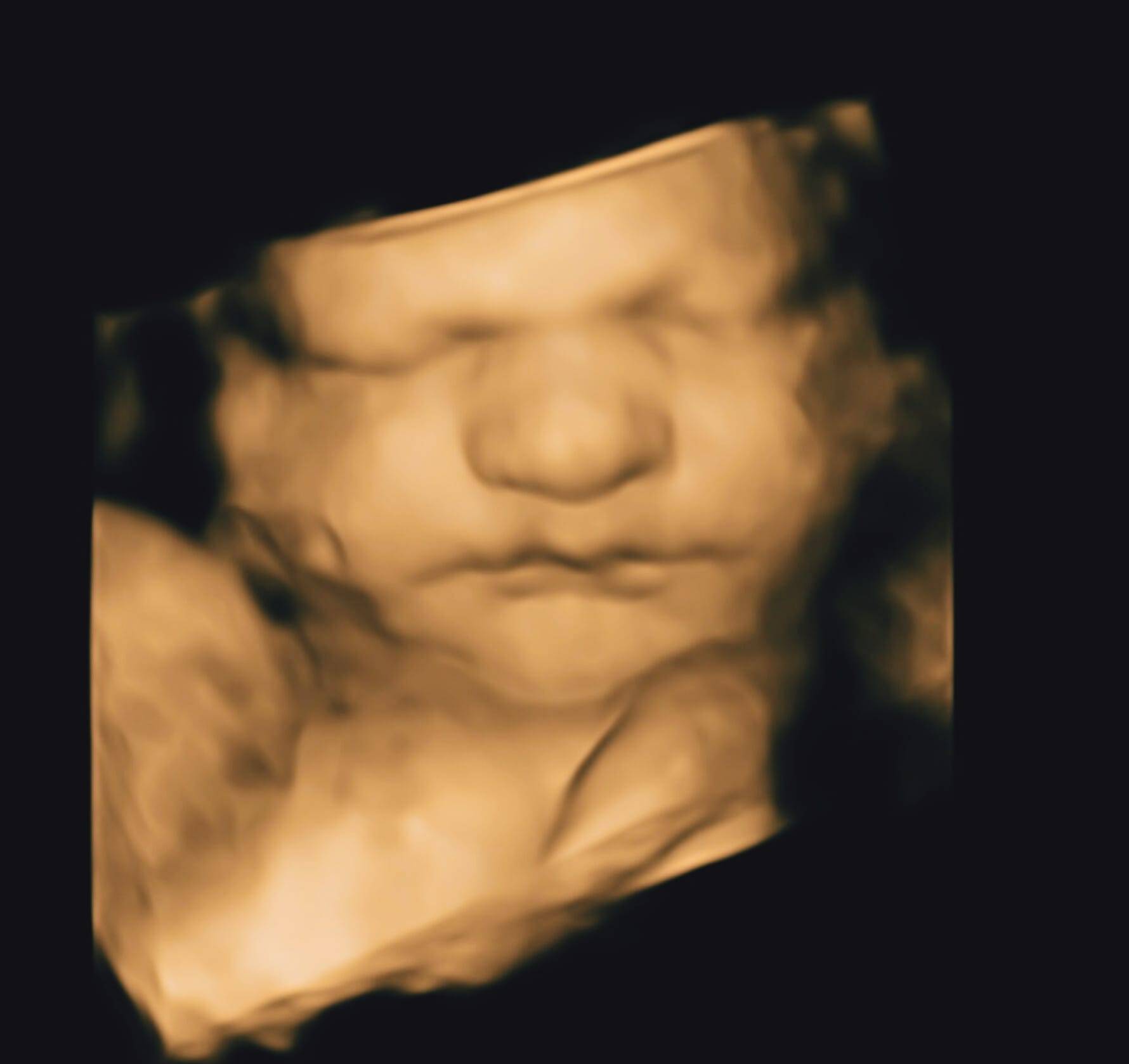 Ultrasound 3D 4D Baby Visuals | Kitchener | Cambridge | Waterloo