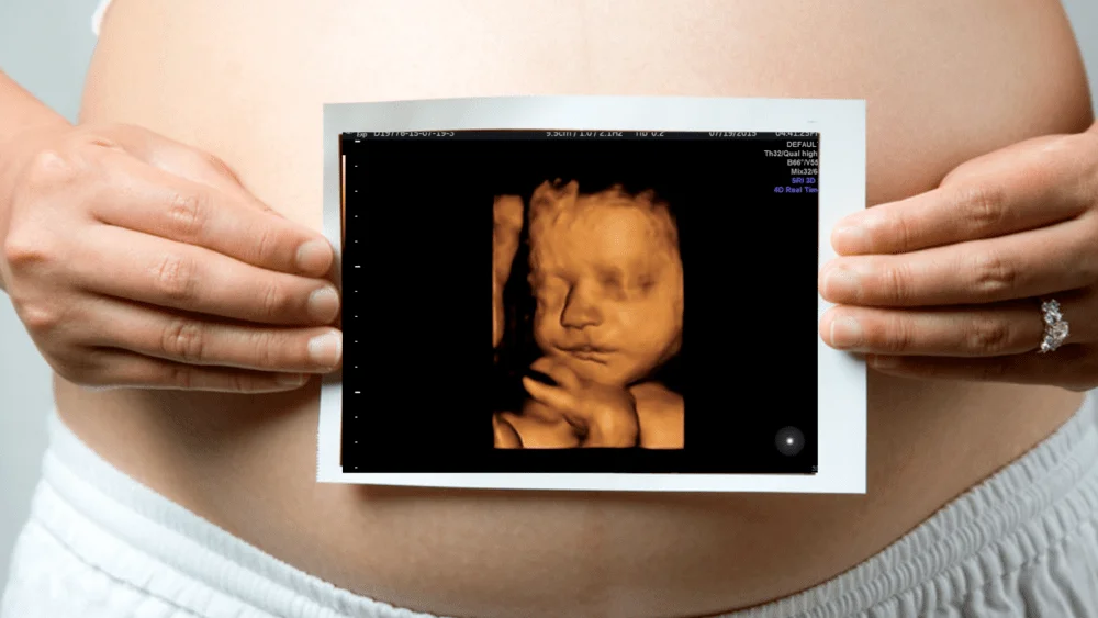 ultrasound Paris Canada-Baby Visuals